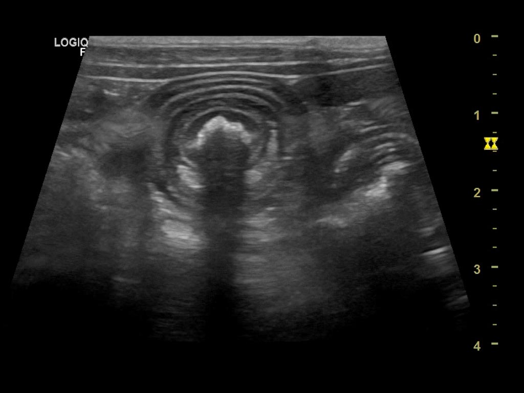 Ecografa Clnica Veterinaria Covadonga, Villaviciosa - Asturias